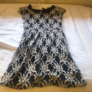 Black and white lace dress